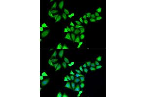 Immunofluorescence analysis of A549 cell using GALE antibody. (GALE Antikörper)