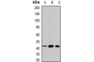 Western blot analysis of Malin expression in mouse brain (A), mouse heart (B), rat liver (C) whole cell lysates.