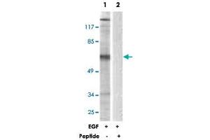 Western blot analysis of extracts from NIH/3T3 cells, treated with EGF (200 ng/mL, 30 mins), using STAM2 polyclonal antibody .