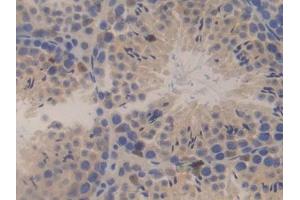 DAB staining on IHC-P; Samples: Mouse Testis Tissue (SSFA2 Antikörper  (AA 587-802))