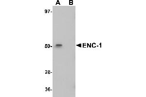 Western Blotting (WB) image for anti-Ectodermal-Neural Cortex 1 (With BTB-Like Domain) (ENC1) (Middle Region) antibody (ABIN1030924) (ENC1 Antikörper  (Middle Region))