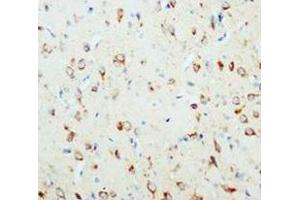 Immunohistochemical analysis of paraffin embedded rat tissue sections (brain), staining NGFbeta in cytoplasm DAB chromogenic reaction