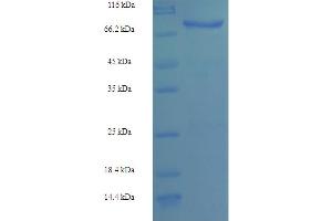 SDS-PAGE (SDS) image for CCCTC-Binding Factor (Zinc Finger Protein)-Like (CTCFL) (AA 1-636), (full length) protein (His-SUMO Tag) (ABIN5709351)