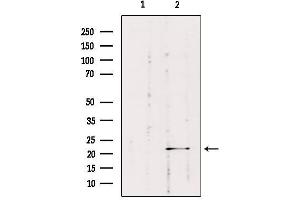 Western blot analysis of extracts from HepG2, using RAB1B Antibody. (RAB1B Antikörper  (Internal Region))