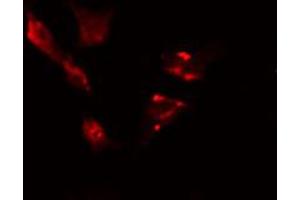 ABIN6274422 staining HeLa cells by IF/ICC. (TBC1D3 Antikörper)