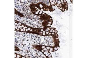 Immunohistochemical staining of human rectum with FAM92B polyclonal antibody  shows strong cytoplasmic positivity in glandular cells. (FAM92B Antikörper)