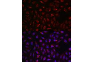 Immunofluorescence analysis of U2OS cells using SDHA Rabbit pAb (ABIN3023399, ABIN3023400, ABIN3023401, ABIN1682638 and ABIN6219706) at dilution of 1:100 (40x lens).