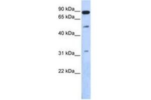 Image no. 1 for anti-SUMO1/sentrin Specific Peptidase 5 (SENP5) (AA 503-552) antibody (ABIN6743841) (SENP5 Antikörper  (AA 503-552))