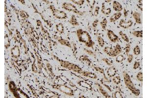 ABIN6272513 at 1/100 staining Human kidney tissue by IHC-P.
