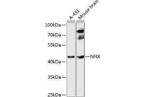 Western blot analysis of extracts of various cell lines, using NFIX antibody (ABIN6129696, ABIN6144568, ABIN6144569 and ABIN6224994) at 1:3000 dilution. (NFIX Antikörper  (AA 180-260))
