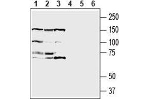 Western blot analysis of human  breast adenocarcinoma cell line lysate (lanes 1 and 4), human  MG glioblastoma cell line lysate (lanes 2 and 5) and human  monocytic leukemia cell line lysate (lanes 3 and 6):1-3. (Insulin-Like Growth Factor 1 Receptor (IGF1R) Peptid)