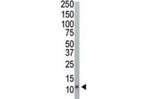 Western Blotting (WB) image for anti-Ubiquitin (Ub) (AA 36-66) antibody (ABIN3029420)