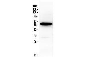 Western blot analysis of Syndecan-1/SDC1 using anti-Syndecan-1/SDC1 antibody . (Syndecan 1 Antikörper  (AA 23-254))