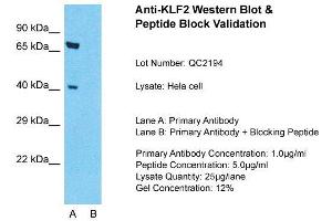 Host: Rabbit  Target Name: KLF2  Sample Tissue: Hela Whole cell  Lane A:  Primary Antibody Lane B:  Primary Antibody + Blocking Peptide Primary Antibody Concentration: 1 µg/mL Peptide Concentration: 5 µg/mL Lysate Quantity: 41 µg/laneGel Concentration:. (KLF2 Antikörper  (Middle Region))