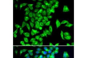 Immunofluorescence analysis of A549 cells using TPH2 Polyclonal Antibody (Tryptophan Hydroxylase 2 Antikörper)