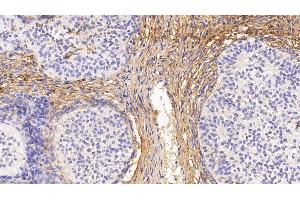 Detection of PIIINP in Human Ovary Tissue using Monoclonal Antibody to Procollagen III N-Terminal Propeptide (PIIINP) (PIIINP Antikörper)