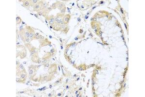 Immunohistochemistry of paraffin-embedded Human stomach using INPP5K Polyclonal Antibody at dilution of 1:100 (40x lens).
