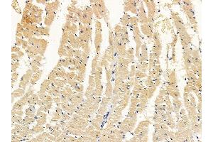 ABIN7094194 and ABIN7098240 at 1/100 staining rat heart tissue by IHC-P. (EHD2 Antikörper  (Internal Region))