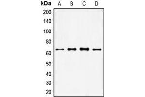 Western blot analysis of FOXO4 expression in HeLa (A), MM142 (B), HuT78 (C), NIH3T3 (D) whole cell lysates. (FOXO4 Antikörper  (Center))