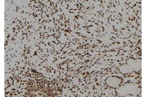 ABIN6278726 at 1/100 staining Human gastric tissue by IHC-P. (Basonuclin 1 Antikörper  (Internal Region))