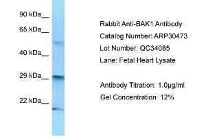WB Suggested Anti-BAK1 Antibody   Titration: 1. (BAK1 Antikörper  (N-Term))