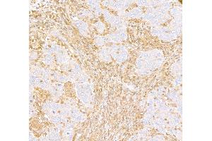 Immunohistochemistry (IHC) image for anti-ARHGDIB/D4-GDI/RhoGDI2 (AA 50-100) antibody (ABIN7453574) (ARHGDIB/D4-GDI/RhoGDI2 (AA 50-100) Antikörper)