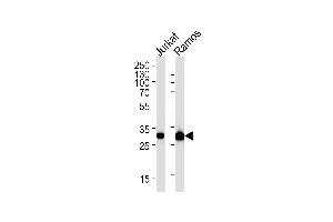 CASP3 Antibody (ABIN1882213 and ABIN2838477) western blot analysis in Jurkat,Ramos cell line lysates (35 μg/lane). (Caspase 3 Antikörper)