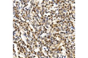 IHC analysis of TIMM29 using anti-TIMM29 antibody (ABIN7601495). (TIMM29 Antikörper  (AA 37-260))