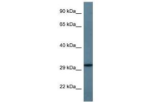 Western Blot showing STX11 antibody used at a concentration of 1 ug/ml against Fetal Heart Lysate