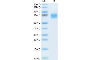 Mouse TYRO3 on Tris-Bis PAGE under reduced condition. (TYRO3 Protein (AA 31-419) (His tag))