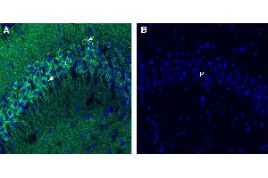 Free-floating frozen brain sections from a paraformaldehyde-perfused mouse were incubated with Anti-Endophilin-A1 antibody (ABIN7884928: 1:300), followed by goat anti-rabbit secondary antibody conjugated to Alexa Fluor® 488 (green).