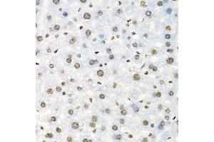 Immunohistochemistry of paraffin-embedded mouse liver using IGF2BP2 antibody.