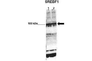WB Suggested Anti-SREBF1 Antibody    Positive Control:  Lane 1: 50ug mouse glomerular endothelial lysate Lane 2: 50ug mouse glomerular endothelial lysate   Primary Antibody Dilution :   1:1000   Secondary Antibody :  Anti-rabbit-HRP   Secondry Antibody Dilution :   1:5000   Submitted by:  Xiaoxin Wang, UC Denver (SREBF1 Antikörper  (N-Term))