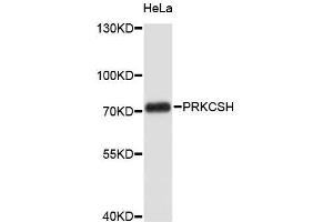 Western blot analysis of extracts of HeLa cells, using PRKCSH antibody (ABIN5972209). (PRKCSH Antikörper)