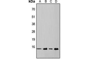 Western blot analysis of 4EBP1 expression in HeLa (A), MCF7 (B), mouse kidney (C), rat liver (D) whole cell lysates. (eIF4EBP1 Antikörper  (Center))
