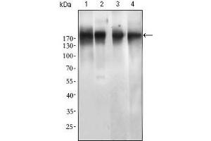 Western blot analysis using EGFR mutant mouse mAb against SPC-A-1 (1), A549 (2), HepG2 (3) and MCF-7 (4) cell lysate. (EGFR Antikörper  (Mutant))