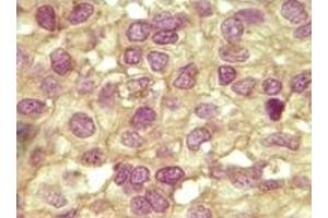 Immunohistochemistry (IHC) image for anti-Inhibin, alpha (INHA) (truncated) antibody (ABIN2464073) (Inhibin alpha Antikörper  (truncated))