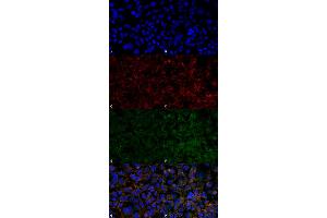 Immunocytochemistry/Immunofluorescence analysis using Mouse Anti-Hexanoyl-Lysine adduct Monoclonal Antibody, Clone 5E8 . (Hexanoyl-Lysine Adduct (HEL) Antikörper (Atto 594))