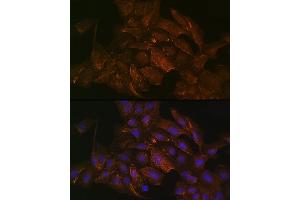 Immunofluorescence analysis of U2OS cells using KRAS+HRAS+NRAS Rabbit mAb (ABIN7267531) at dilution of 1:100 (40x lens).