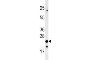 Western Blotting (WB) image for anti-Frataxin (FXN) antibody (ABIN3002642) (Frataxin Antikörper)