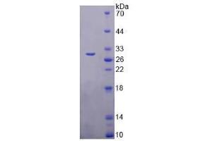 SDS-PAGE analysis of Human TMEM173 Protein. (STING/TMEM173 Protein)