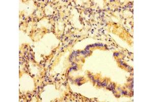 Immunohistochemistry (IHC) image for anti-phosphoprotein Associated with Glycosphingolipid Microdomains 1 (PAG1) (AA 97-432) antibody (ABIN7163391)