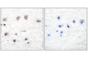 Immunohistochemistry (IHC) image for anti-Adducin 1 (Alpha) (ADD1) (pSer726) antibody (ABIN1847203) (alpha Adducin Antikörper  (pSer726))