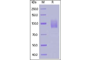 SDS-PAGE (SDS) image for Guanylate Cyclase 2C (Heat Stable Enterotoxin Receptor) (GUCY2C) (AA 24-430) (Active) protein (Fc Tag) (ABIN7013421)