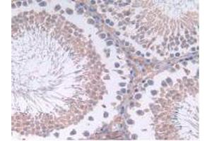 IHC-P analysis of Rat Testis Tissue, with DAB staining. (IL12A Antikörper  (AA 23-215))