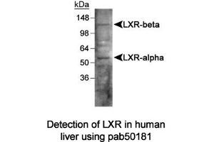 Image no. 1 for anti-Liver X Receptor (LXR) antibody (ABIN363490) (Liver X Receptor Antikörper)