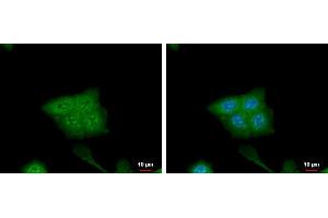 ICC/IF Image CRABP2 antibody [N1C3] detects CRABP2 protein at cytoplasm and nucleus by immunofluorescent analysis. (CRABP2 Antikörper)