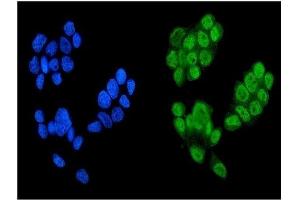 IF analysis of KDM5B using anti-KDM5B antibody (ABIN4886648). (KDM5B Antikörper  (Middle Region))