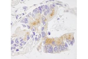 Immunohistochemistry (IHC) image for anti-Echinoderm Microtubule Associated Protein Like 4 (EML4) (AA 150-200) antibody (ABIN7448551)