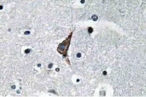 Immunohistochemistry (IHC) analyzes of TLR4 antibody in paraffin-embedded human brain tissue. (TLR4 Antikörper)